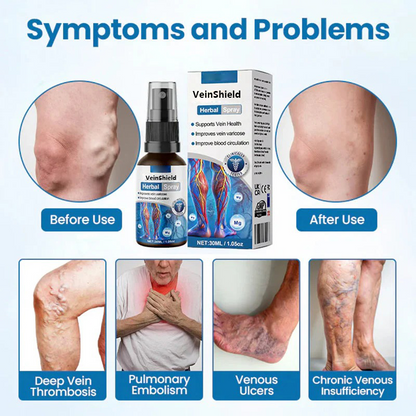 🔥 Last 3 Hours: Bigger Discount on the Second Item! 🔥 VeinShield Herbal Spray - 94% of users see visible results within 1 to 2 weeks!