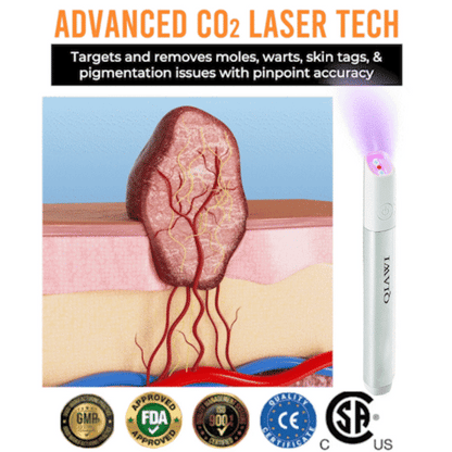 ✨QIAWI™ All-in-One CO₂ Laser Eraser Pen | Removes Moles, Warts, Skin Flaws & Pigmentation